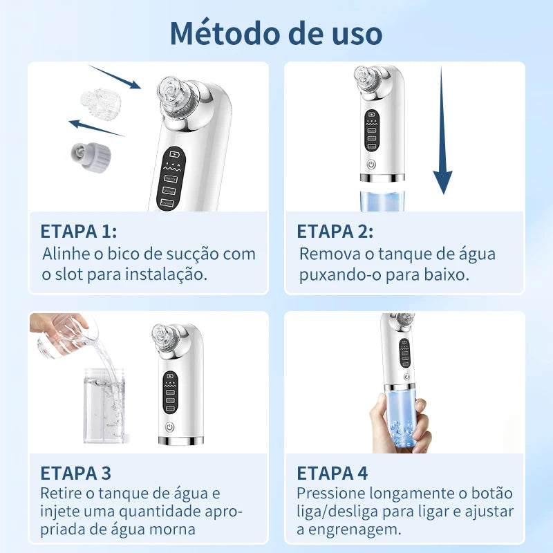 Removedor elétrico de cravos, remoção de espinhas, acne, sucção a vácuo, limpador de poros, limpeza facial