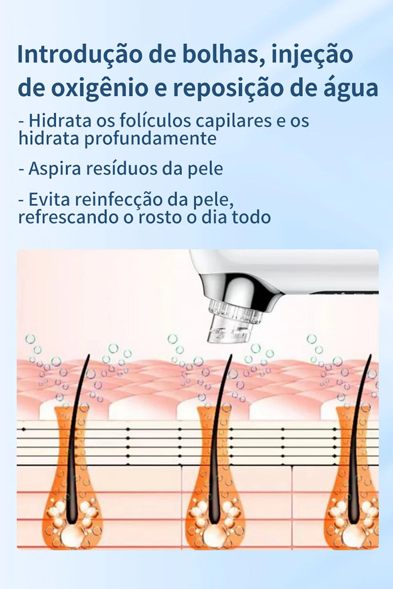 Removedor elétrico de cravos, remoção de espinhas, acne, sucção a vácuo, limpador de poros, limpeza facial