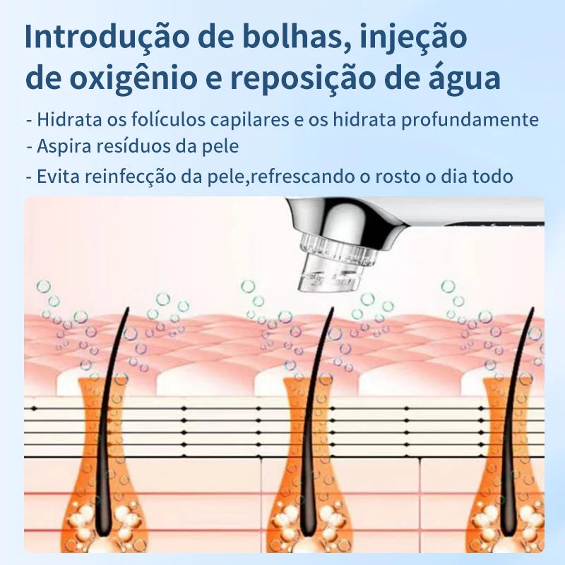 Removedor elétrico de cravos, remoção de espinhas, acne, sucção a vácuo, limpador de poros, limpeza facial